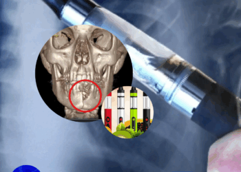 Venezuela Decreta Ilegal el cigarrillo electrónico.